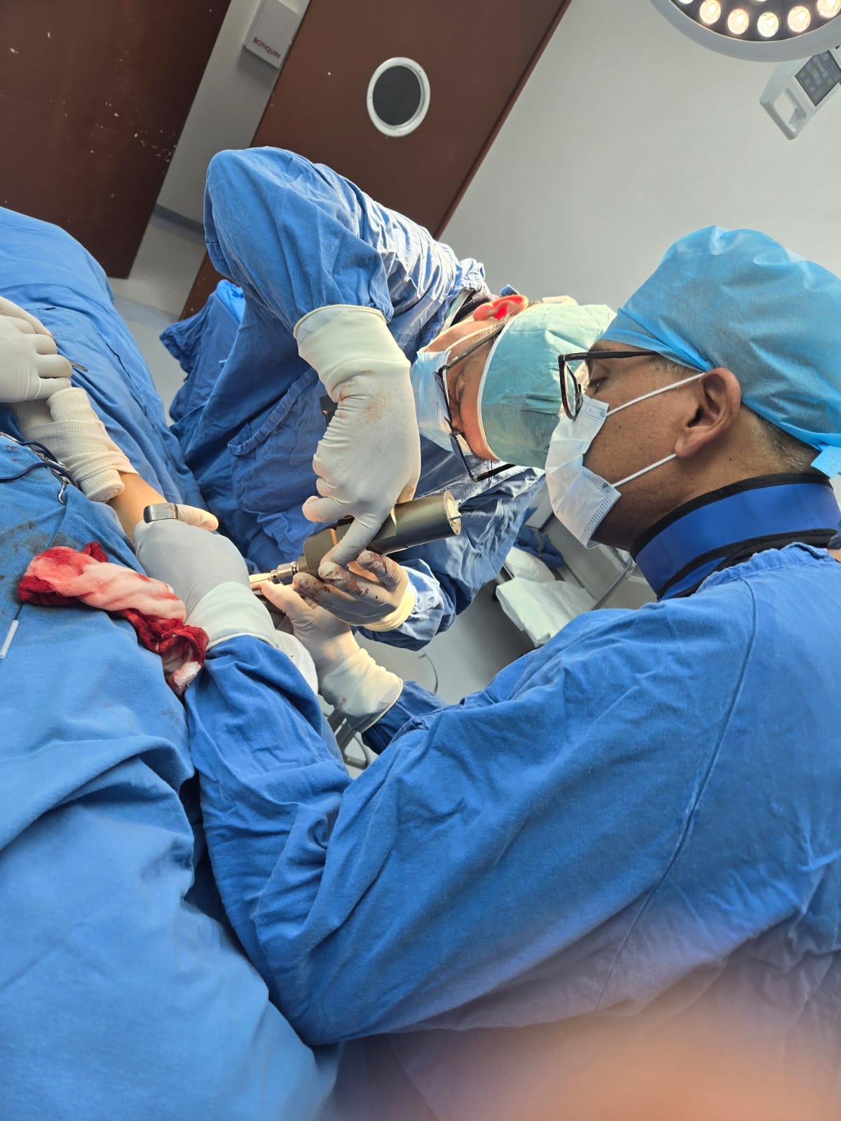 Anastomosis microquirúrgica de arteria radial (injerto de vena safena invertida por defecto de 4 cm)